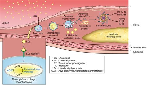 Patofisiologi Acute Coronary Syndrome