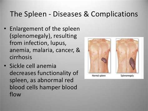 The Spleen