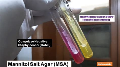 Mannitol Salt Agar (MSA): Introduction, Composition, Preparation, Uses