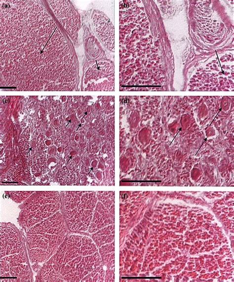 Histology of human trigeminal ganglion. Panel a shows the edge of a... | Download Scientific Diagram