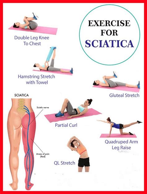 Sciatica Pain: Symptoms & Relief | Xcell Medical Group | Elyria, Ohio