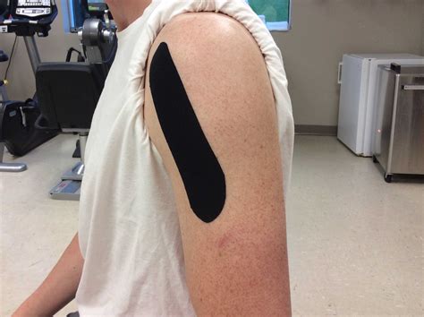 Support Your Shoulder With Kinesiology Tape