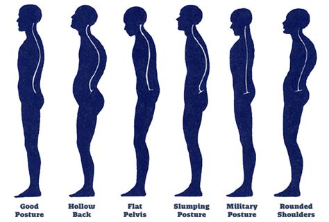 Why Does Posture Matter? | Body One Physical Therapy