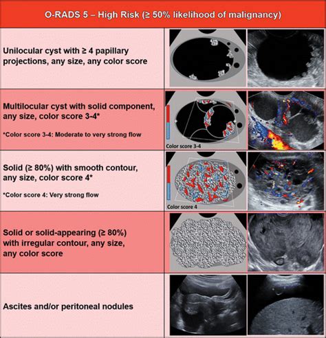 O-RADS US Risk Stratification and Management System: A Consensus ...