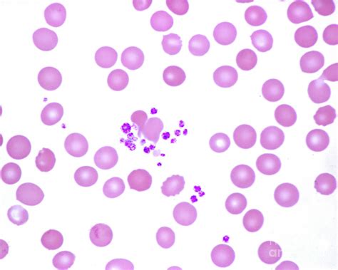 Human Blood Smear With Platelets Photograph by Jose Calvo / Science ...