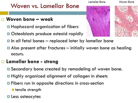 lamellar bone nd woven difference - Google Search | Woven, Bones, Healing