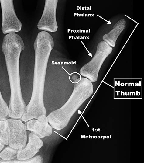 All Thumbs in NFL Camp - Week 1