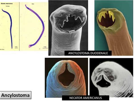 Hookworm infection, symptoms, diagnosis & hookworm treatment in humans