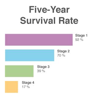 Liver Cancer Survival Rate Stage 1 - CancerWalls