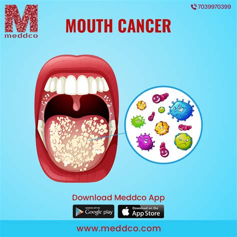 Symptoms Of Mouth Cancer Pictures - Infoupdate.org