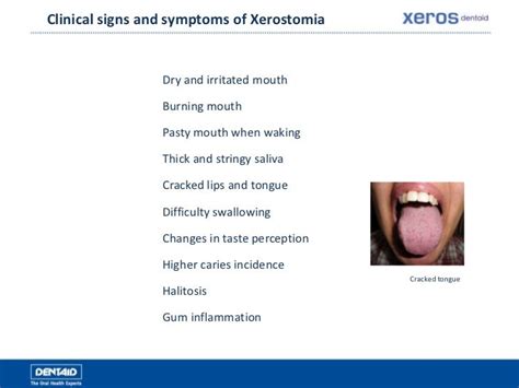 What is Xerostomia?