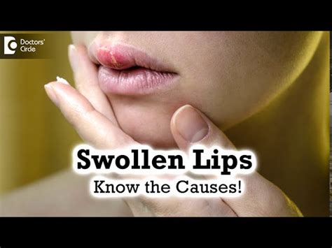 What Can Swollen Lips Mean | Sitelip.org