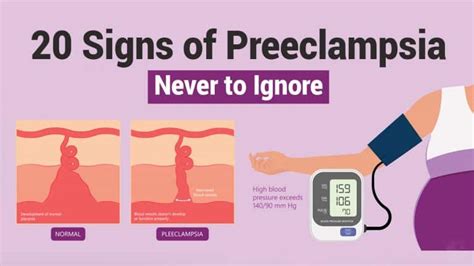 20 Signs of Preeclampsia Never to Ignore | 5 Minute Read