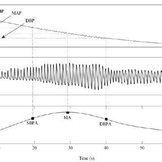 An example of the deflating cuff pressure (CP) waveform, pulsatile... | Download Scientific Diagram