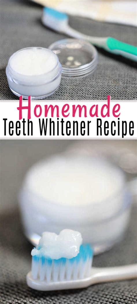 DIY Teeth Whitening - Home Made Teeth Whitening