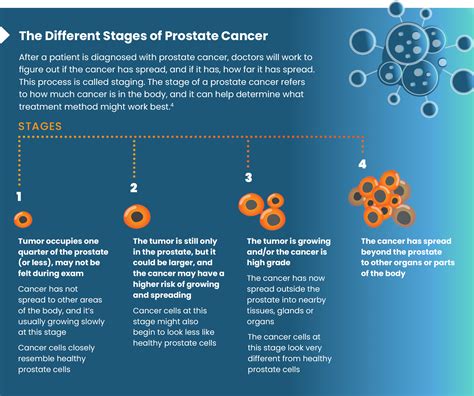 Prostate Cancer Factsheet - CAMCEVI