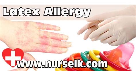 Latex Allergy | Nurselk.com