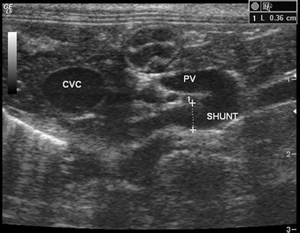 Imaging of Congenital Portosystemic Shunts - MSPCA-Angell