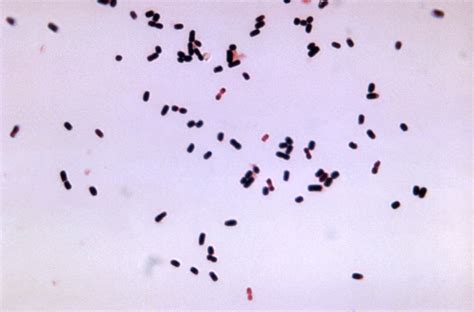 Free picture: gram, photomicrograph, gram, positive, clostridium perfringens, welchii