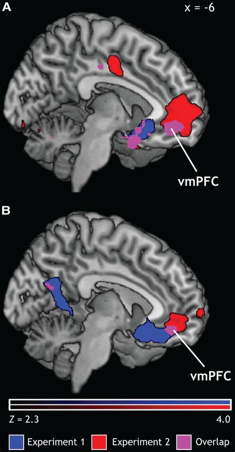 Ventromedial Prefrontal Cortex Encodes Emotional Value | Journal of ...