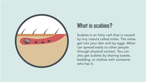 Scabies: What is, Symptoms, Treatment, Prevention, and Useful Facts | December 2023