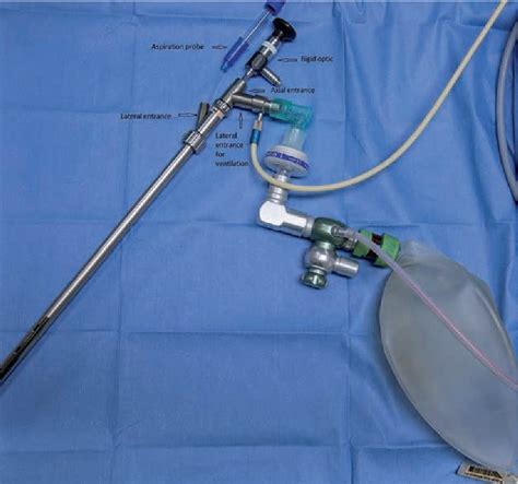 Figure 1 from Anesthesia for adult rigid bronchoscopy. | Semantic Scholar