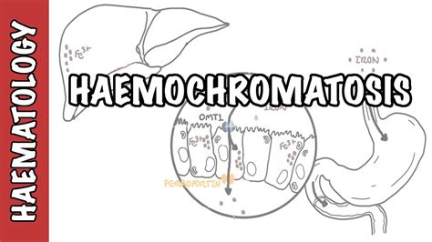 Haemochromatosis (Iron Overload) - iron physiology, causes and pathophysiology - YouTube