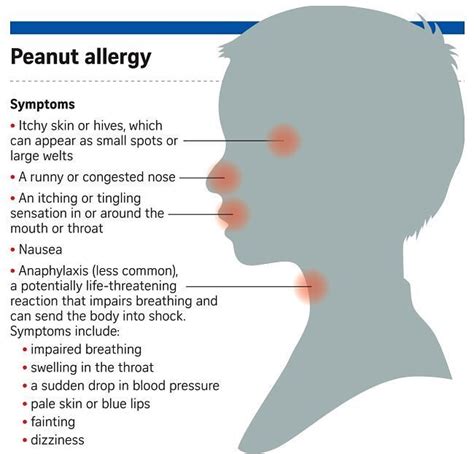 Pin on Help with Allergies and Asthma