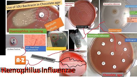 Haemophilus Influenzae: Introduction, Morphology, Pathogenecity, Laborat