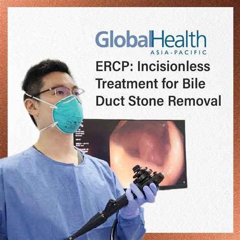 GlobalHealth: ERCP: Incisionless Treatment for Bile Duct Stone Removal ...