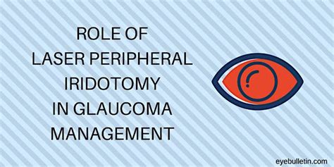 Laser Peripheral Iridotomy Procedure and Its Role in Glaucoma ...