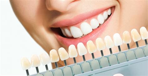 Aesthetic Smile Design | Dentevim Dental Clinic