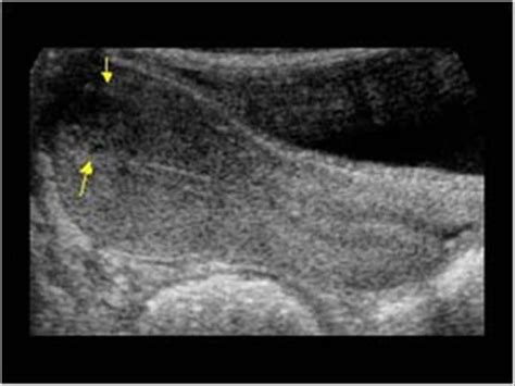 Pin on Female Pelvic Ultrasound