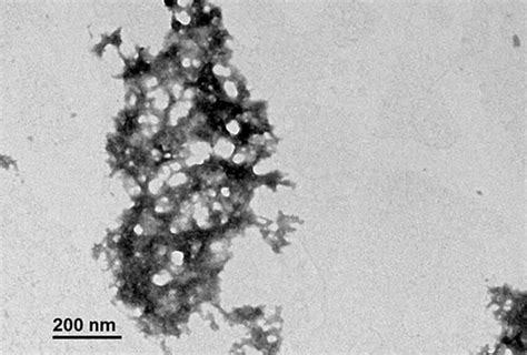 Representative photomicrograph of negative staining for transmission... | Download Scientific ...