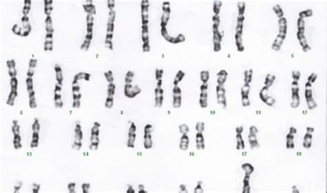 Where Did The Y Chromosome Come From? | Asian Scientist Magazine | Science, Technology and ...