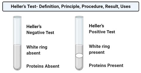 Heller’s Test- Definition, Principle, Procedure, Result, Uses