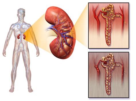 What is the Difference Between Uremia and Azotemia | Compare the Difference Between Similar Terms