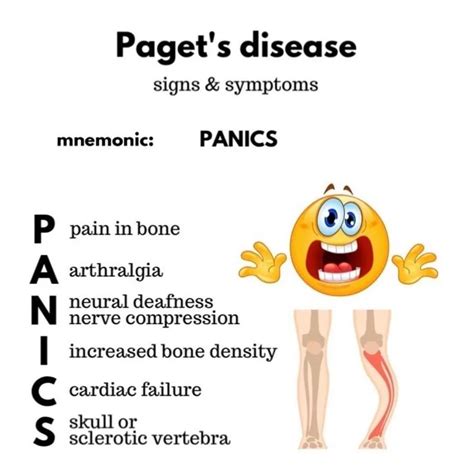 Pagets Disease Of The Bone Cause Symptoms Treatment | Hot Sex Picture