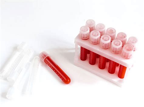 Antimitochondrial Antibody Test - MBBCH Health Encyclopedia