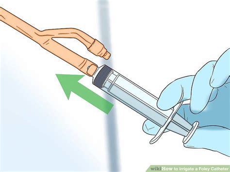 How to Irrigate a Foley Catheter (with Pictures) - wikiHow