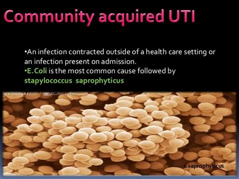 urinary tract infections-Lab diagnosis (e.coli, klebsilla, proteus, p…