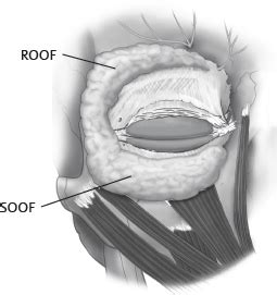 29. Periorbital Anatomy | Plastic Surgery Key