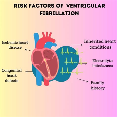 Ventricular tachycardia : Causes, Risk Factors, Symptoms, Treatment