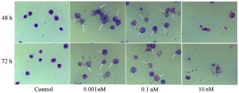 Induction of apoptosis and erythroid differentiation of human chronic myelogenous leukemia K562 ...