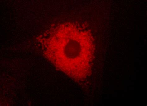 Lysosomes in Distressed Cells with LysoTracker Red | MicroscopyU