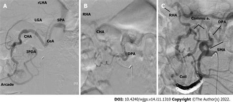 Celiac Artery Angiogram