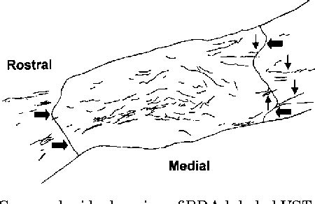 Structure of rubrospinal tract | Semantic Scholar