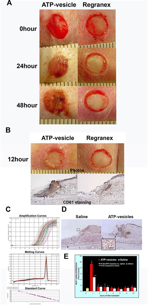 Role Of Granulation Tissue In Wound Healing at Dorothy Nims blog