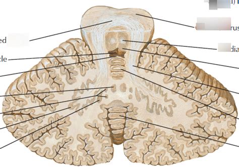 Section in plane of superior cerebellar peduncle Diagram | Quizlet