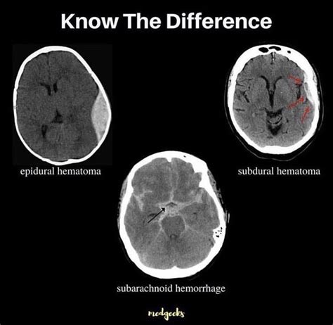 Pin by Andres Sanchez on NeuroAnatomy | Medical radiography, Medical ...